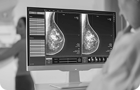Breast cancer screening tests